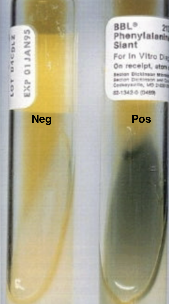 <p>Proteus</p><p>Morganella</p><p>Providencia</p>