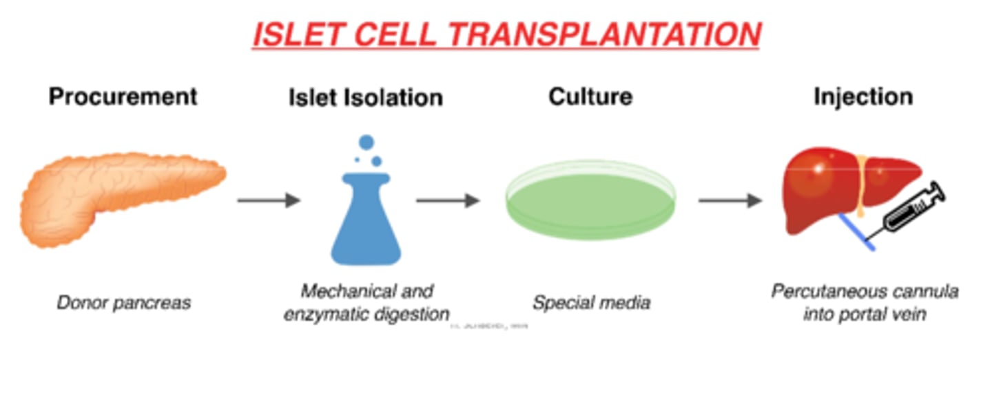<p>1. procurement (removal) of donor pancreas</p><p>2. islet isolation via mechanical & enzymatic digestion in lab</p><p>3. culture on special media in lab</p><p>3. injection of islet cells via percutaneous cannula into portal vein</p><p>4. islet cells in the body!</p>