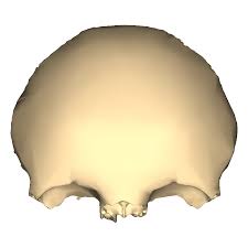 <p>Identify the bone.</p>