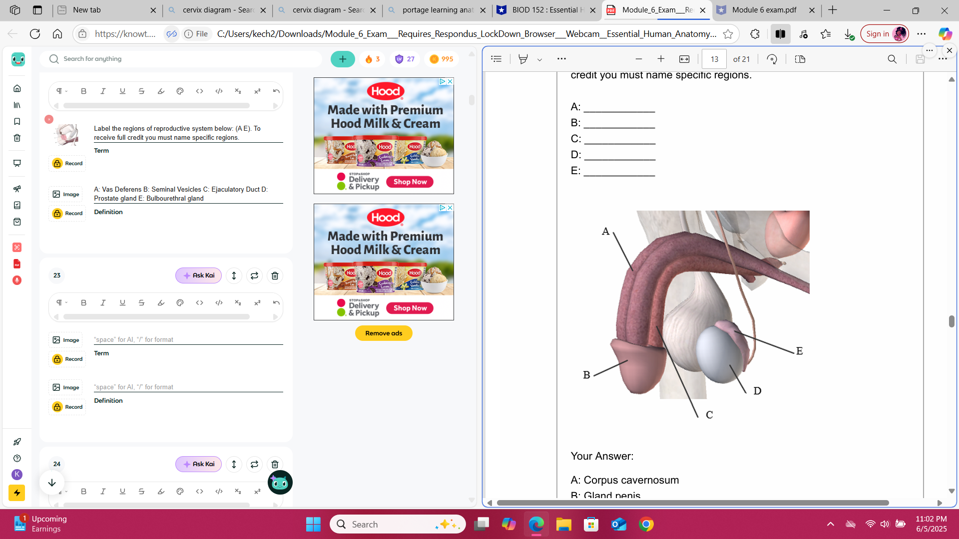 <p>Label the regions of reproductive system below: (A-E) To receive full credit you must name specific regions. A: ____________ B: ____________ C: ____________ D: ____________ E: ____________</p>