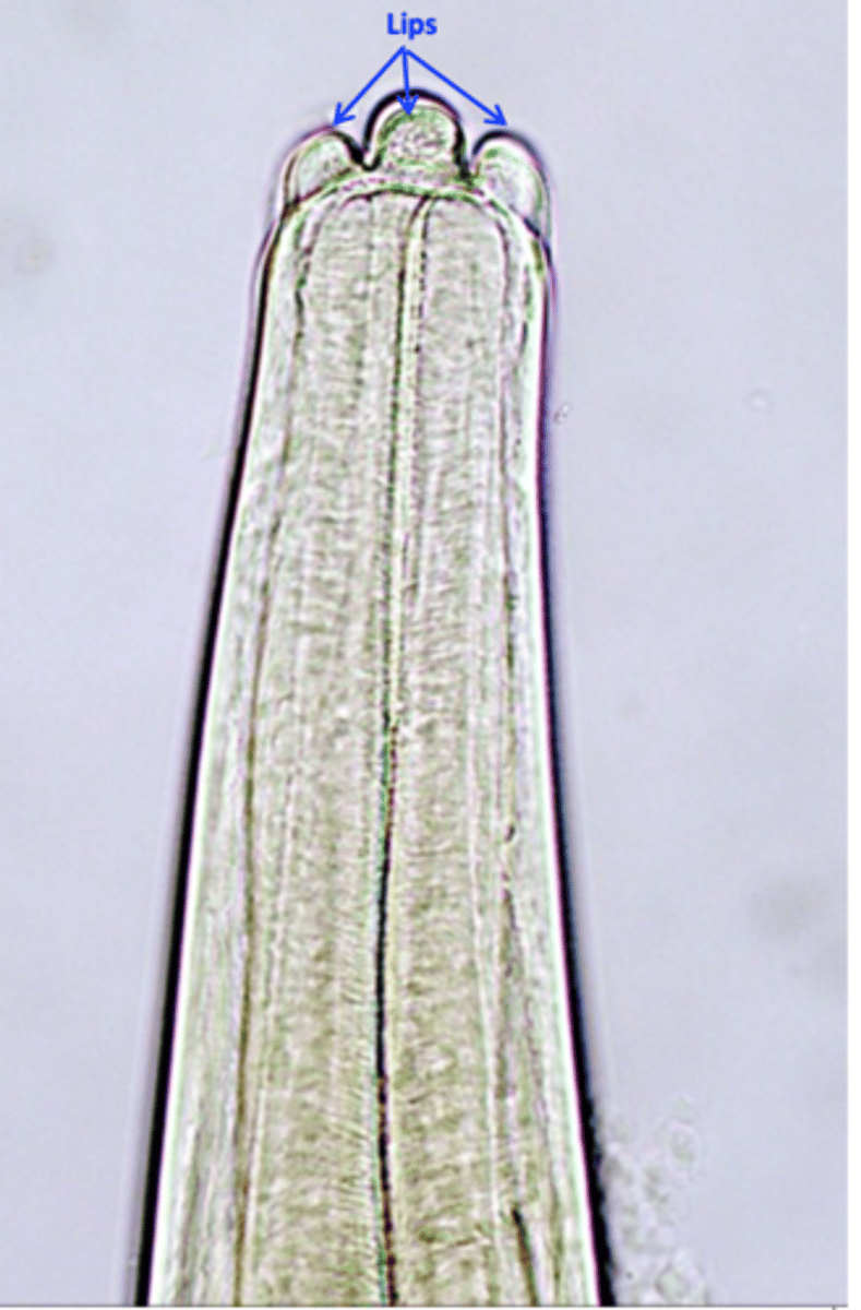 <p>Location: bronchi, bronchioles</p>
