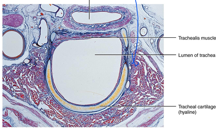<p>The trachea has 16-20 incomplete rings of cartilage, joined by <strong>dense connective tissue</strong></p>