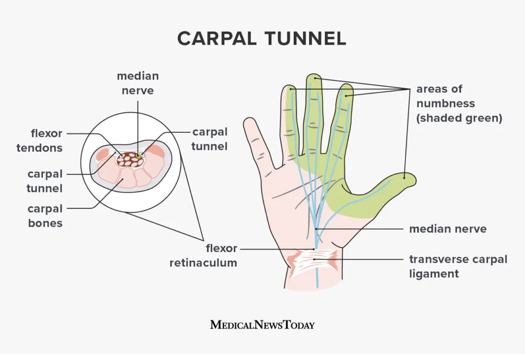 <p>relate to the wrist bones / connected to the forearm</p>