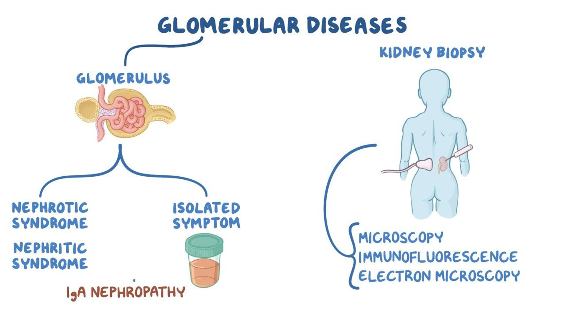 <p>Post-renal</p>