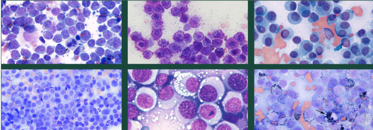 <p>Label the round cell neoplasia </p>