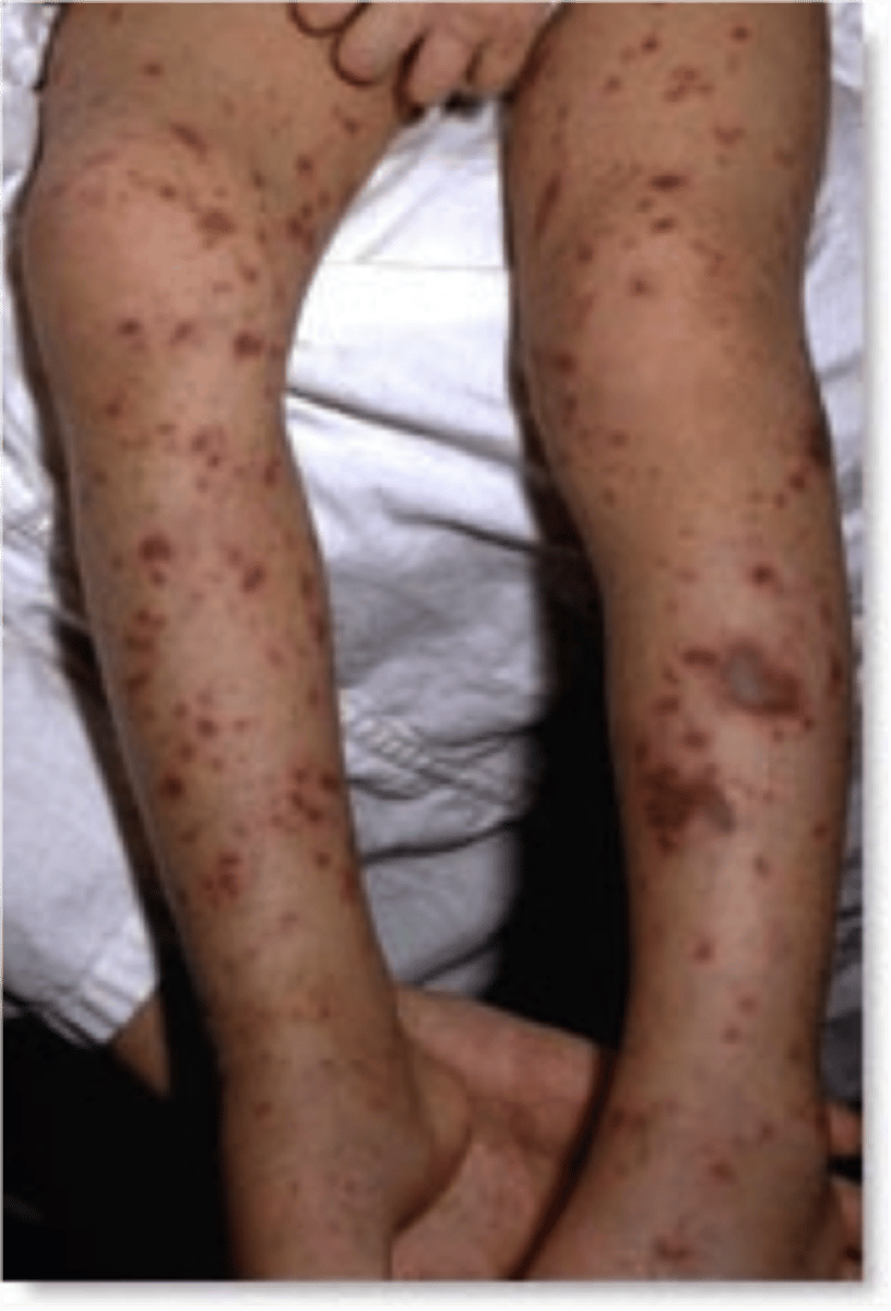 knowt flashcard image