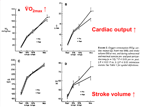 <ol><li><p>Removed pericardium (lining of heart)</p></li></ol><p></p>