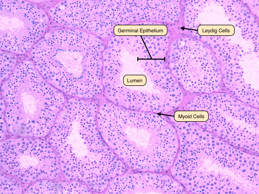 <p>part of the male reproductive system that make sperm and hormones, located outside the body, generally under the penis; produces primarily testosterone</p>