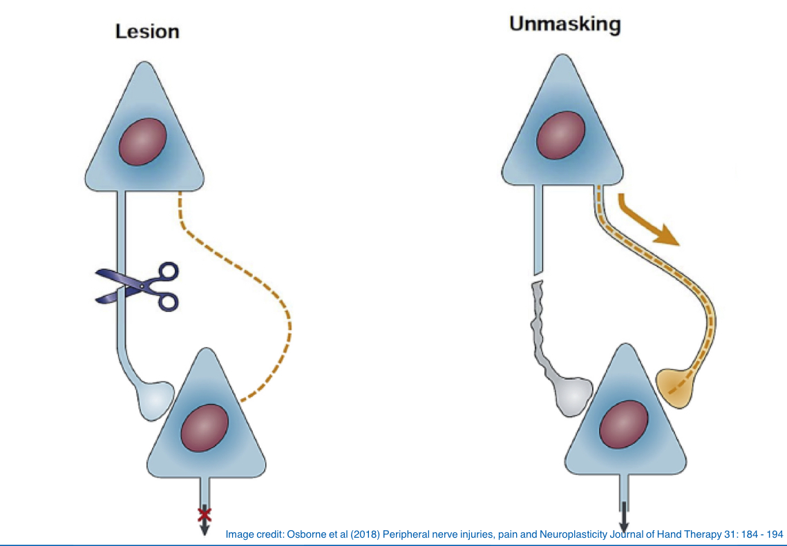 <p>Several synapses may mediate the same function in the brain, and some may be very active while others are redundant or ‘silent’</p><p>Unmasking is the phenomenon whereby silent synapses are facilitated to become the primary synapses of the damaged areas of the brain</p><p>Success depends on denervation supersensitivity, learning dependent synaptogenesis and long term potentiation</p>