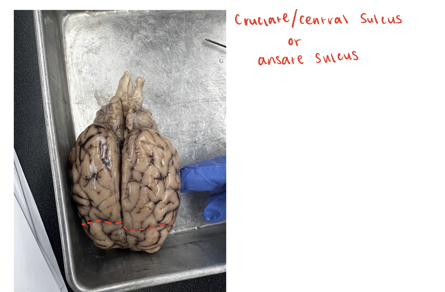 <p>(O) or ansate sulcus; divides frontal lobe and parietal lobe</p>