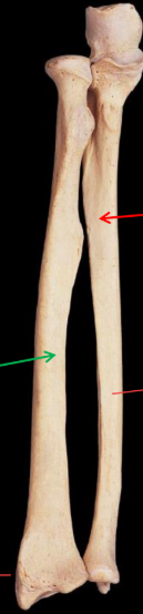 <p>What is the left bracket?</p>