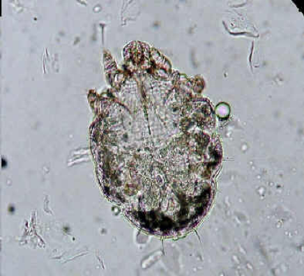 <p>what kind of mite</p>