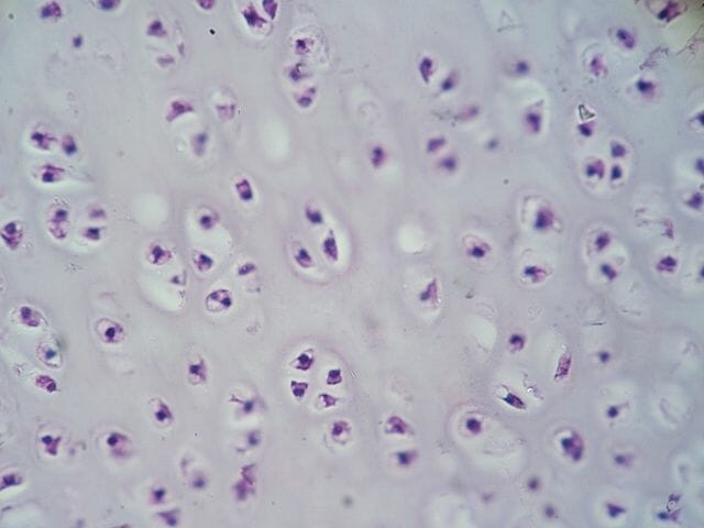 cartilage