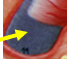 <p>Hair Follicle</p>