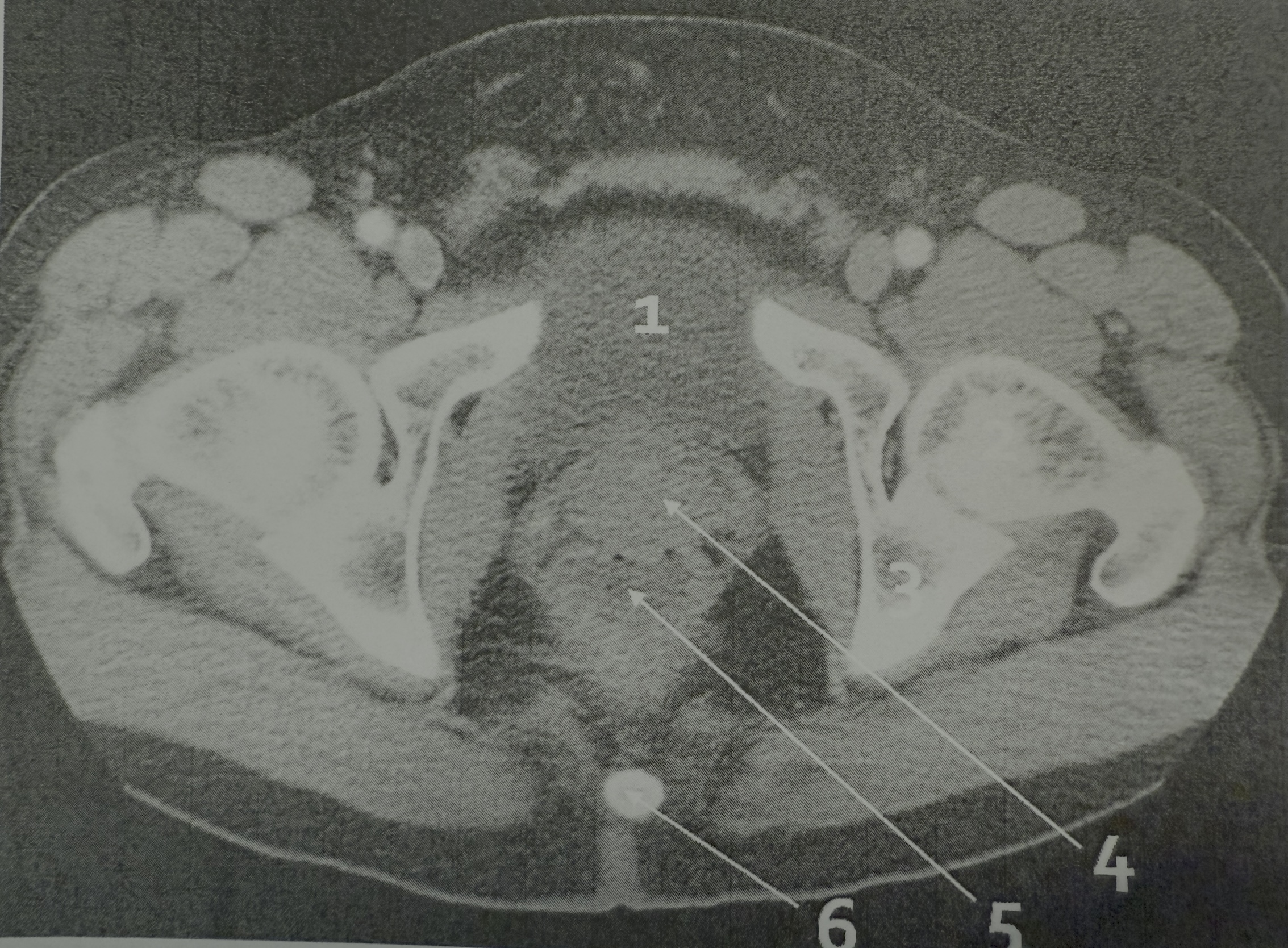 <p>6</p>