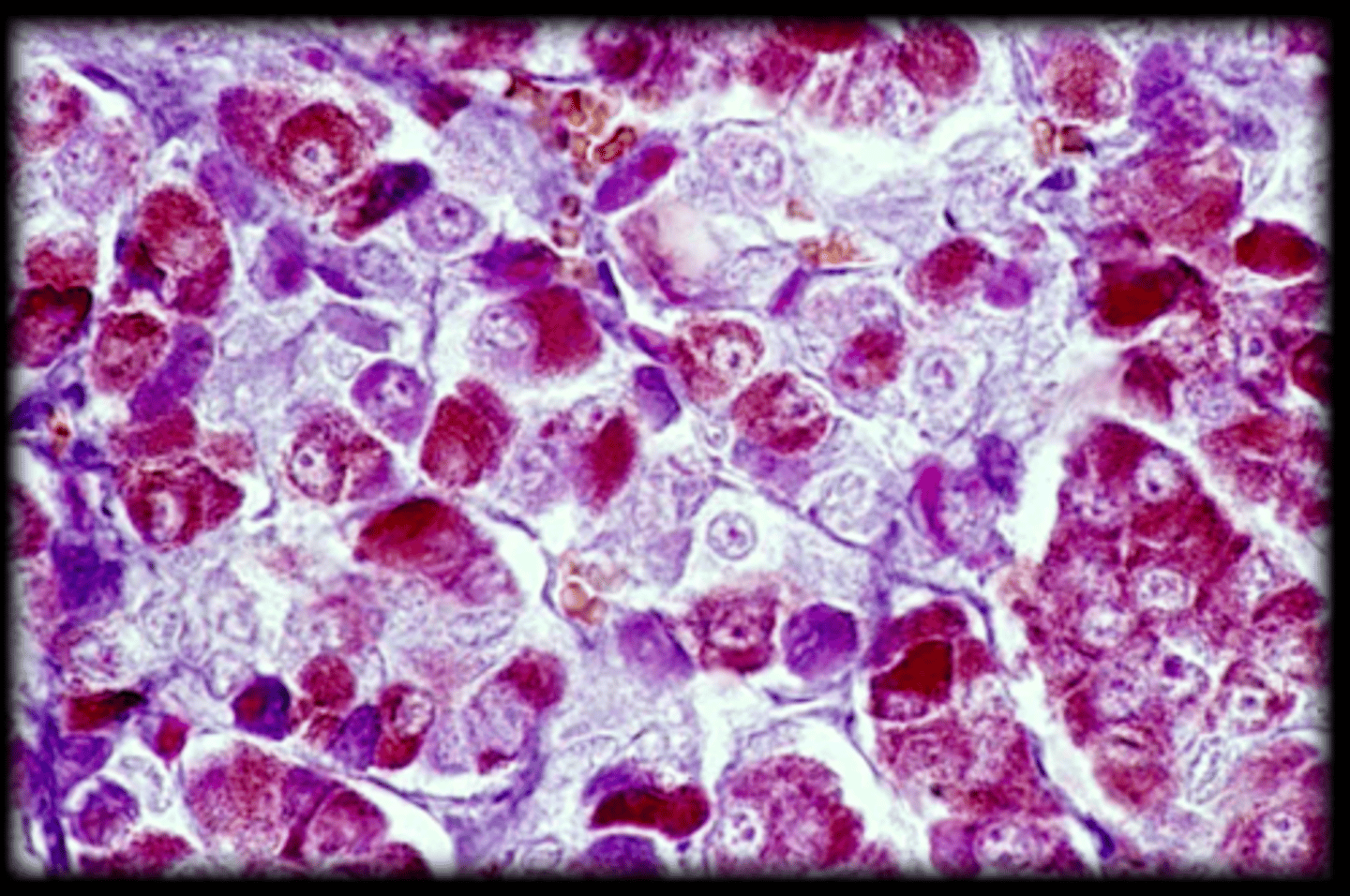 <p>darkest stained cells</p>