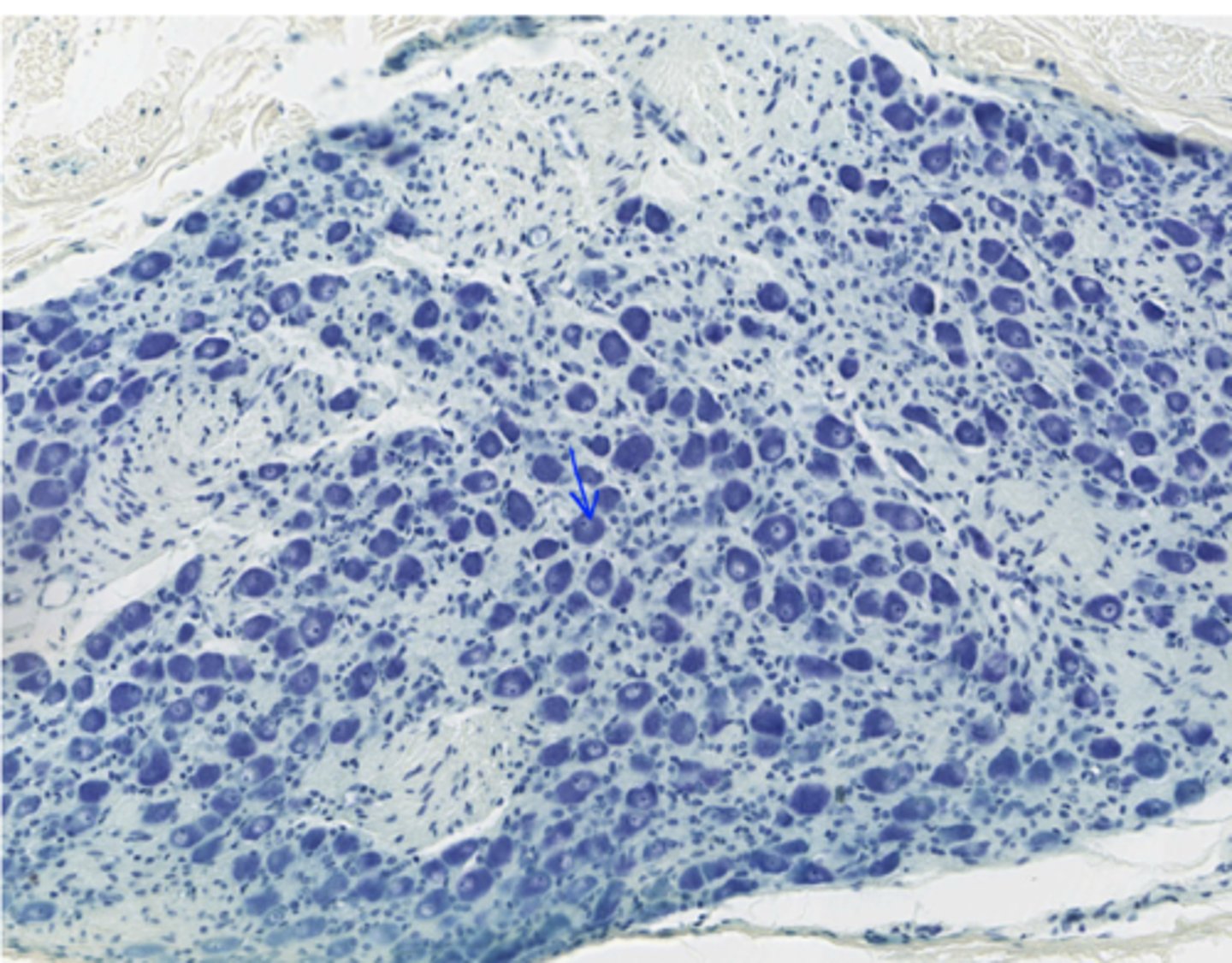 <p>Identify the following organ in the PNS</p>