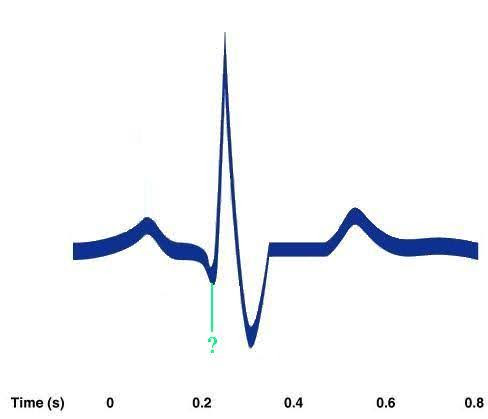 <p><span><span>Identify the indicated portion of the EKG.</span></span></p>