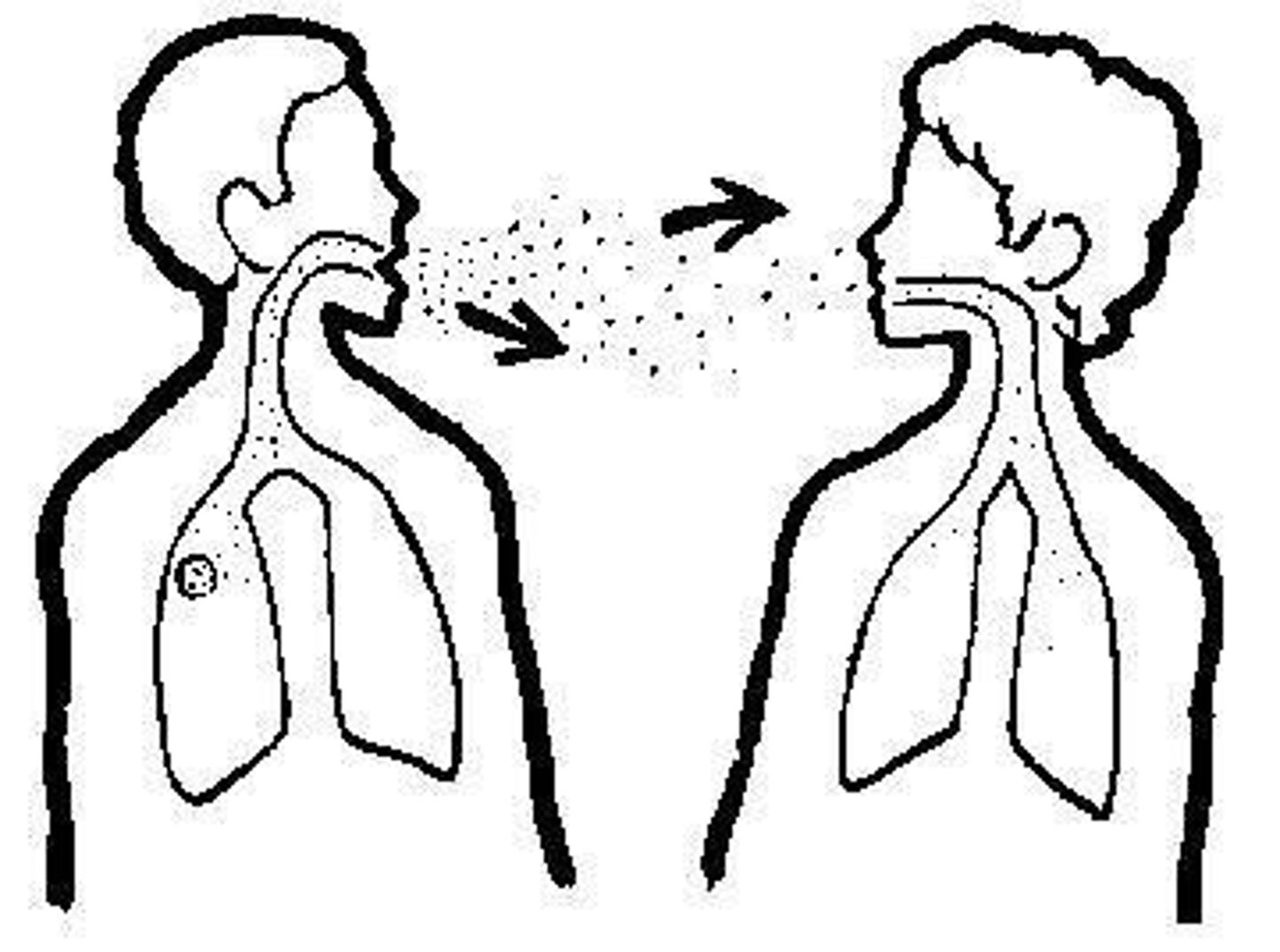 <p>dễ lây lan, truyền nhiễm</p><p><em>The infection is highly contagious, so don't let anyone else use your towel.</em></p>