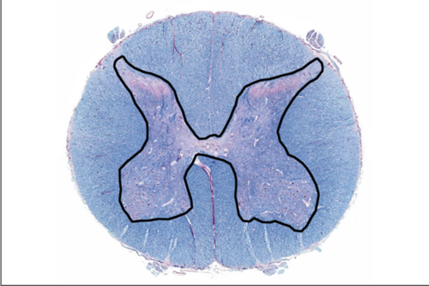 <p>brain and spinal cord tissue that is gray consists mainly of neuronal cell bodies (nuclei) and lacks myelinated axons</p>