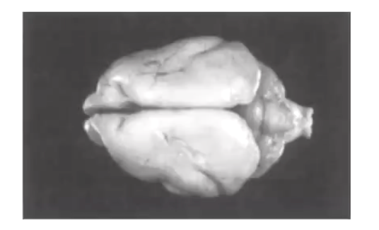 <p><strong>• Slow or failed neuronal migration of brain neurons = Lack of development of the surface folding of the cerebrum</strong></p><ul><li><p>Characterized by a small, smooth-appearing cerebrum with rudimentary or absent gyri (agyria) and sulci.</p></li></ul><p></p>