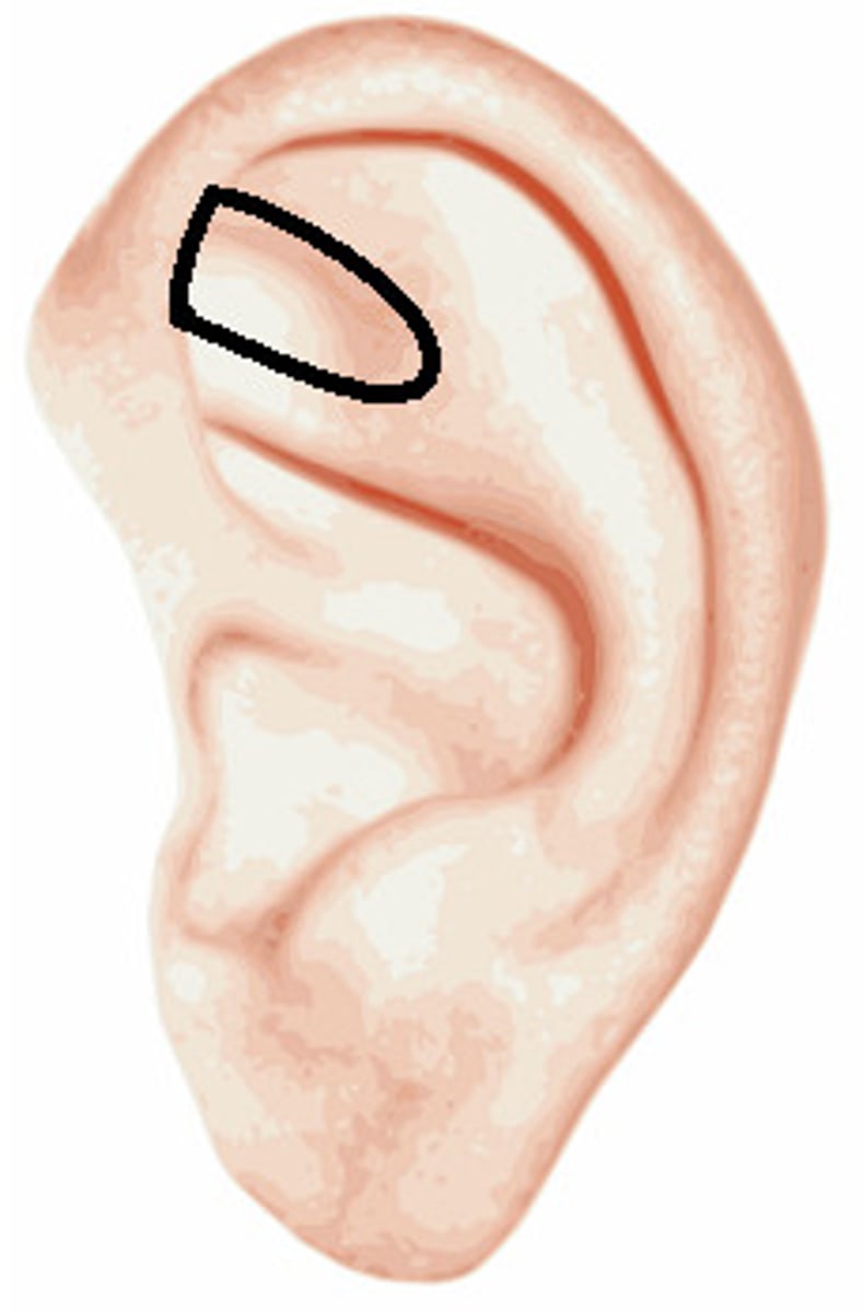 <p>a depression of the antihelix</p>