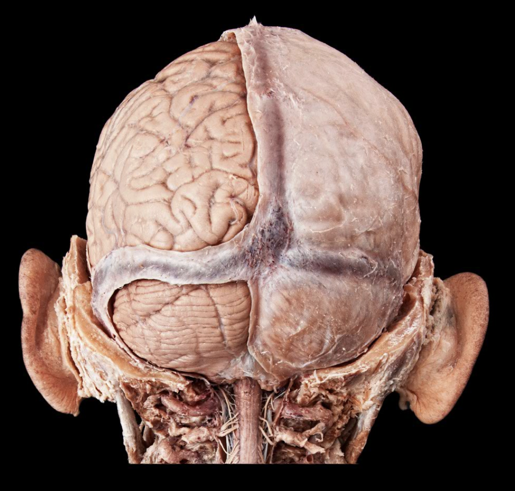<p>dura mater </p>