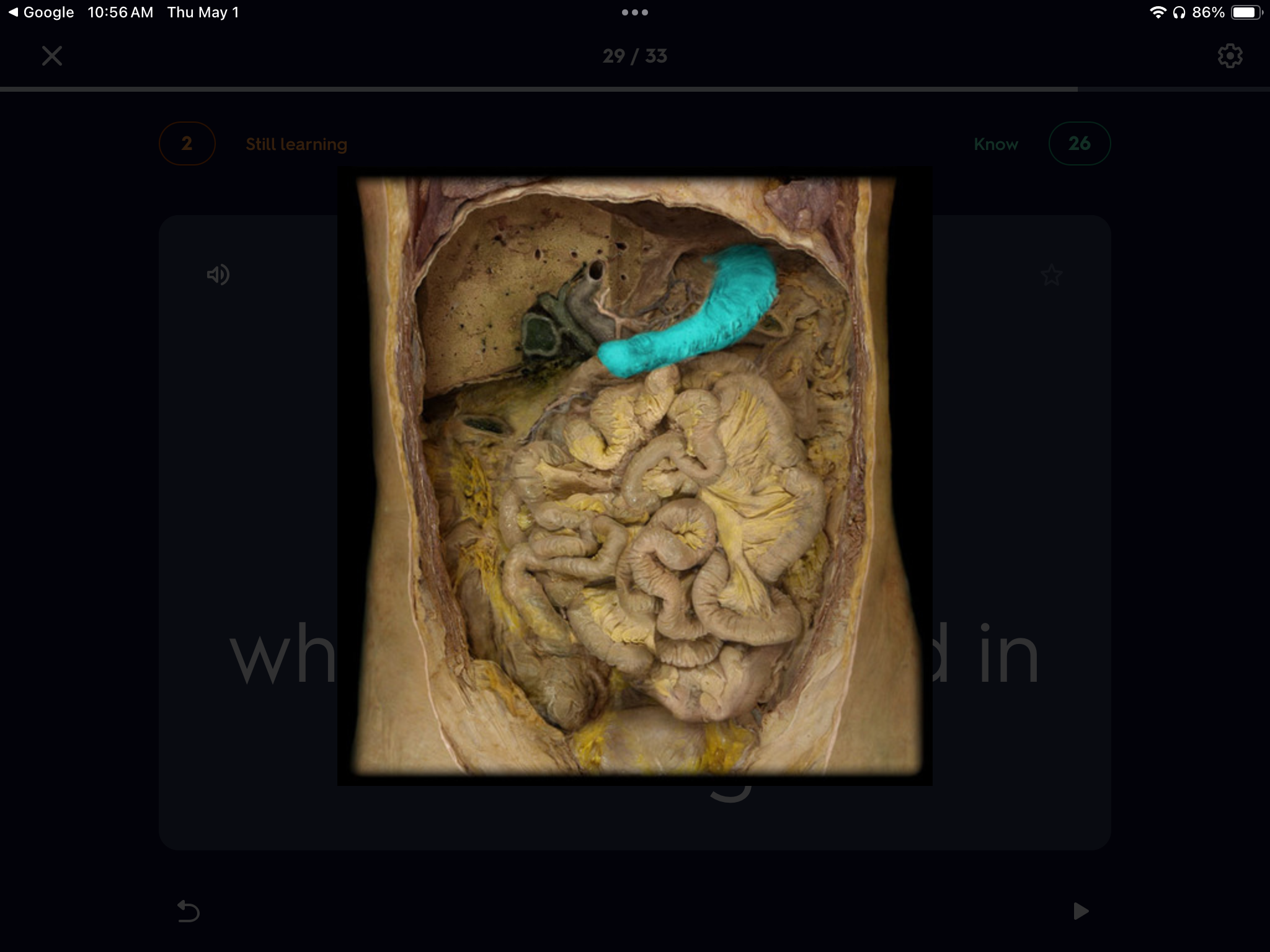 <p>What is this organ highlighted that plays a major role in the digestive system?</p>