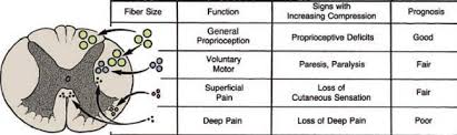 <p>The smaller the fibres, the worse the prognosis. The smallest fibres do not have a myelin sheath → no protection → do not regenerate.</p><p>A. Proprioceptive deficits (good)</p><p>B. Paresis/paralysis (fair)</p><p>C. Loss of cutaneous sensation (fair)</p><p>D. Loss of deep pain (poor)</p>