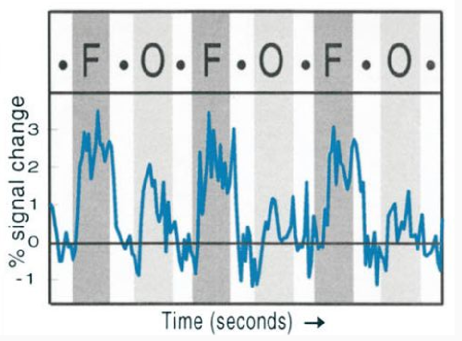 <p>Region responds more to faces than … Houses, objects, bodies, scenes.</p>