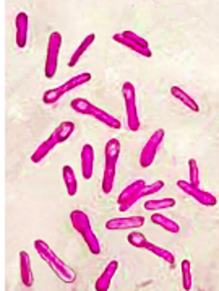 <p>Foodborne botulism = ingestion of toxin in improper canned foot</p><p>Infant botulism = intestinal infection e.g., consumption of honey</p><p>Wound botulism = infection of a wound, IV drug use</p><p>Adult intestinal botulism </p>