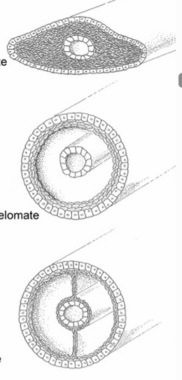 <p>Which is a coelomate? A(top), C (bottom). What makes it C?</p>