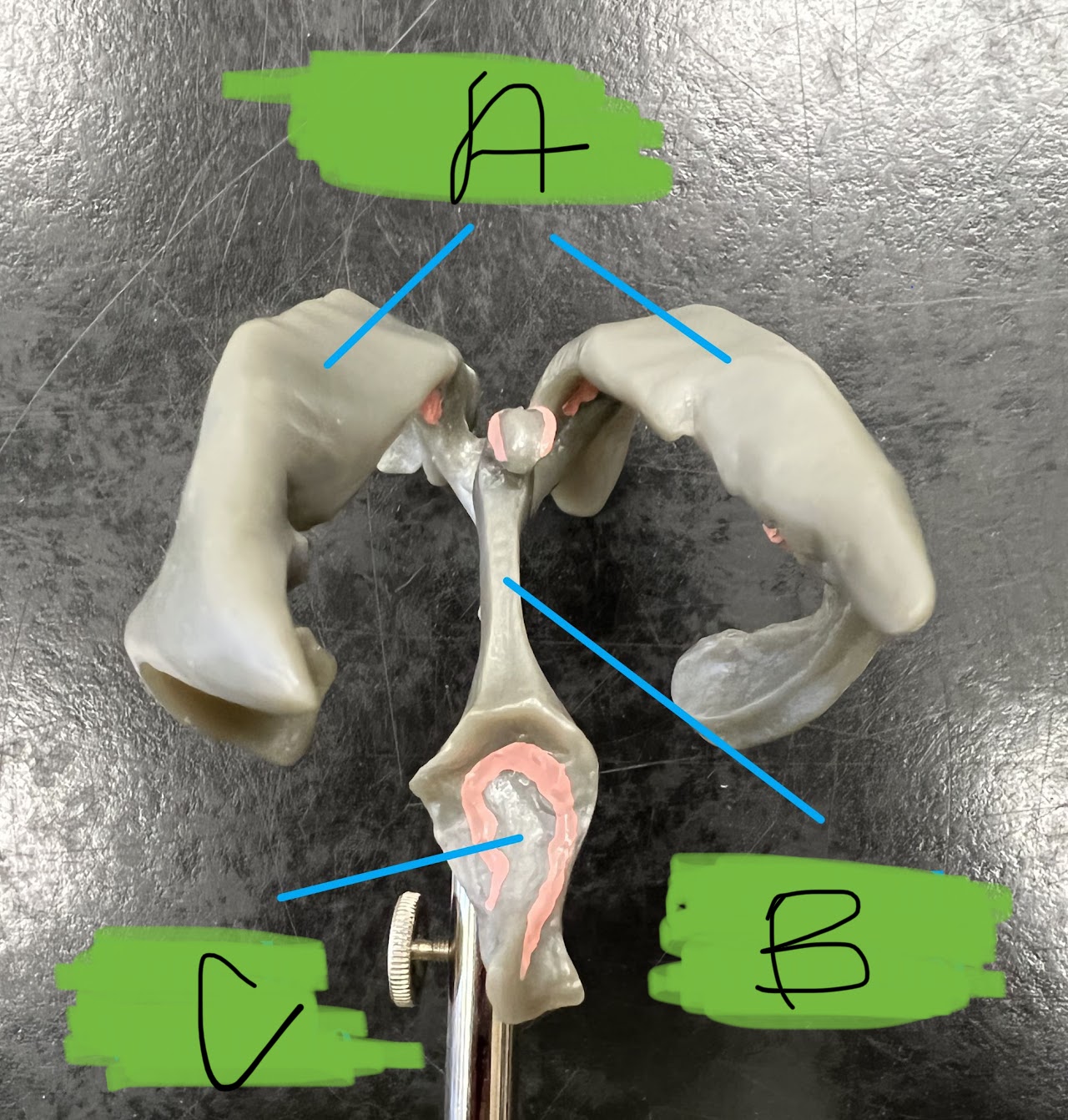 A