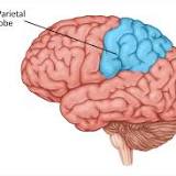 <p>near the back and top of the head. do the processing and interpreting of somatosensory input so objects in our external environment through touch and position and movement of our body parts.</p><p><strong>Damage</strong>: Difficulty with drawing objects, difficulty in distinguishing left from right, spatial disorientation and navigation difficulties, problems with reading and writing, visual attention</p><p><strong>Visual Neglect</strong>: Right side injury would have a patient with neglect to behave as if the left side of sensory space is nonexistent (although they can still turn left). might fail to eat the food on the left half of their plate, when asked to draw a clock,drawing might show only numbers 12 to 6, or all 12 numbers on one half of the clock face, the other side being distorted or left blank.may also ignore the contralesional side of their body,may frequently collide with objects or structures such as door frames on the side being neglected.</p>