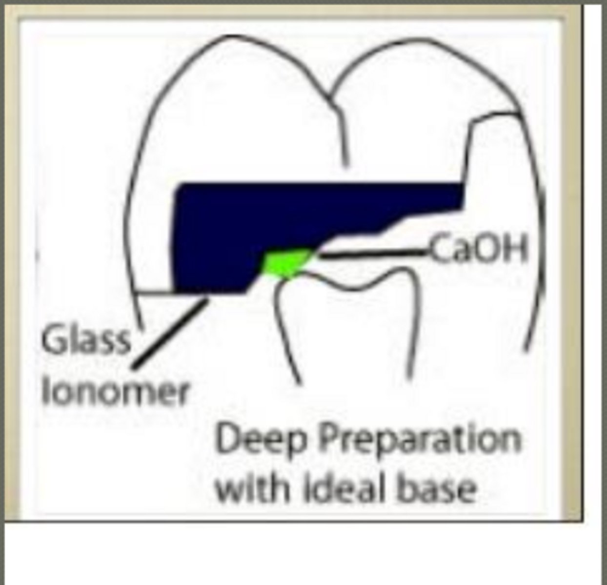 <p>- thermal protection</p><p>- protect CaOH</p><p>- mechanical support</p><p>- restore ideal prep form</p><p>- resist compressive forces (of mastication)</p><p>- block out undercuts for indirect restorations</p>
