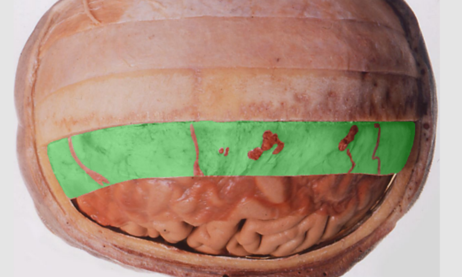 <p>What meninges is this?</p>