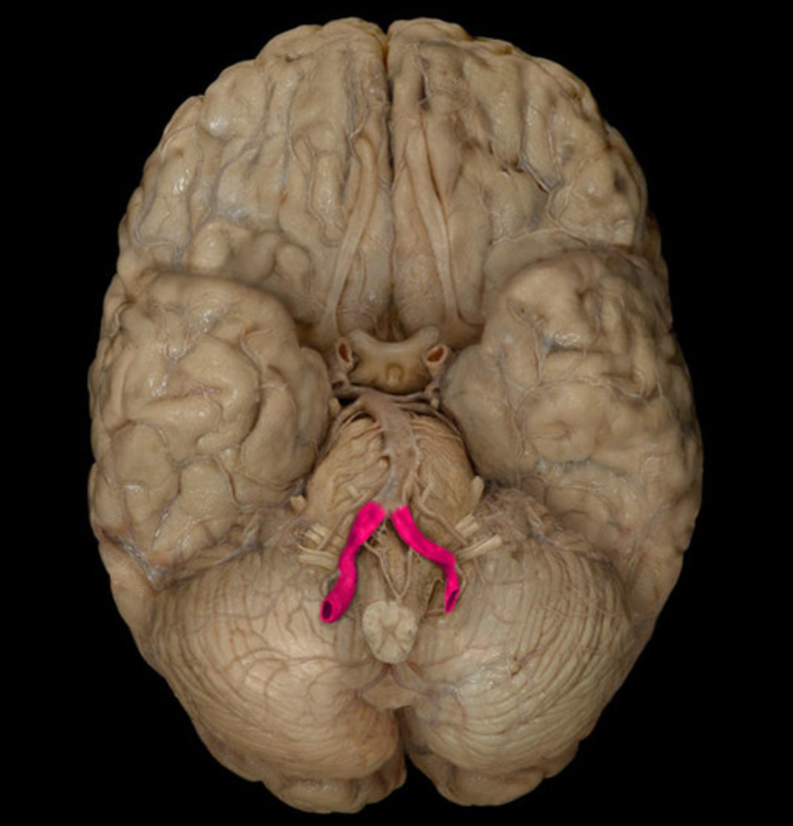 <p>supply the brain</p>