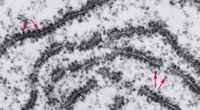 What structure is pointed at in the photo and what microscope/technique was used?