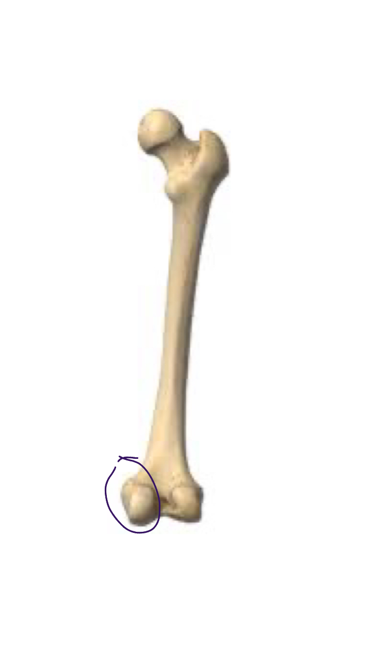 <p>Aligns with head of femur </p>