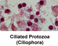 <p>major pathogenic protozoa: Ciliated protozoa</p>
