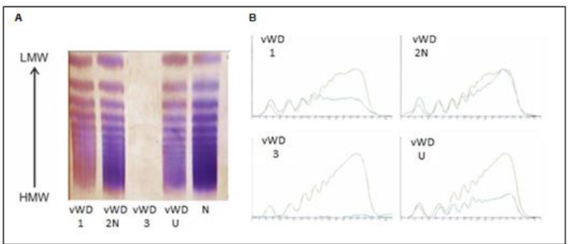 <ul><li><p>Used to determine correct disease subtype</p><ul><li><p>Gel electrophoresis</p><ul><li><p>Low concentration of agarose (0.65%)</p></li><li><p>Staining w Ab to VWF</p></li><li><p>Type is determined by electrophoretic pattern</p></li></ul></li><li><p>Also useful for diagnosing TTP</p><ul><li><p>Presence of unusually large VWF (UL-VWF) multimers indicates decreased ADAMTS-13 activity</p></li></ul></li><li><p>Performed in specialized reference labs or coagulation centers</p></li></ul></li></ul><p></p>