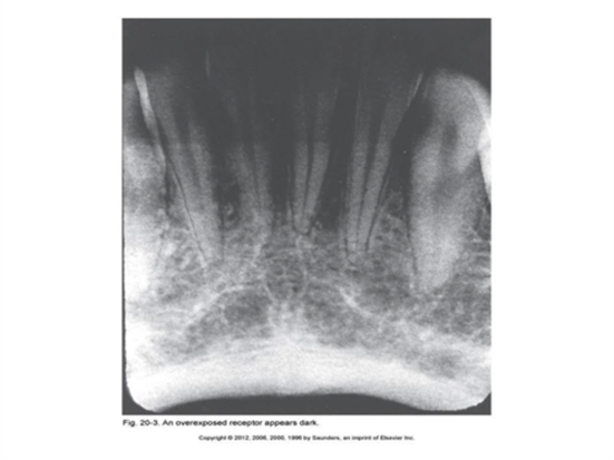 <p><span>What receptor exposure error caused the image to appear as above?</span></p>