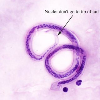 <ul><li><p>sheathed</p></li><li><p>tapered tail to point</p></li><li><p>nuclei singly do not extend to tip\</p></li><li><p>individually visible nuclei</p></li></ul><p></p>
