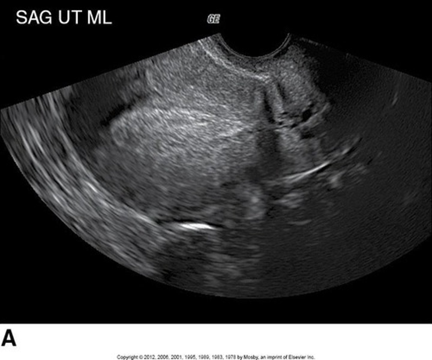 <p>Methodology for conducting the ultrasound examination.</p>