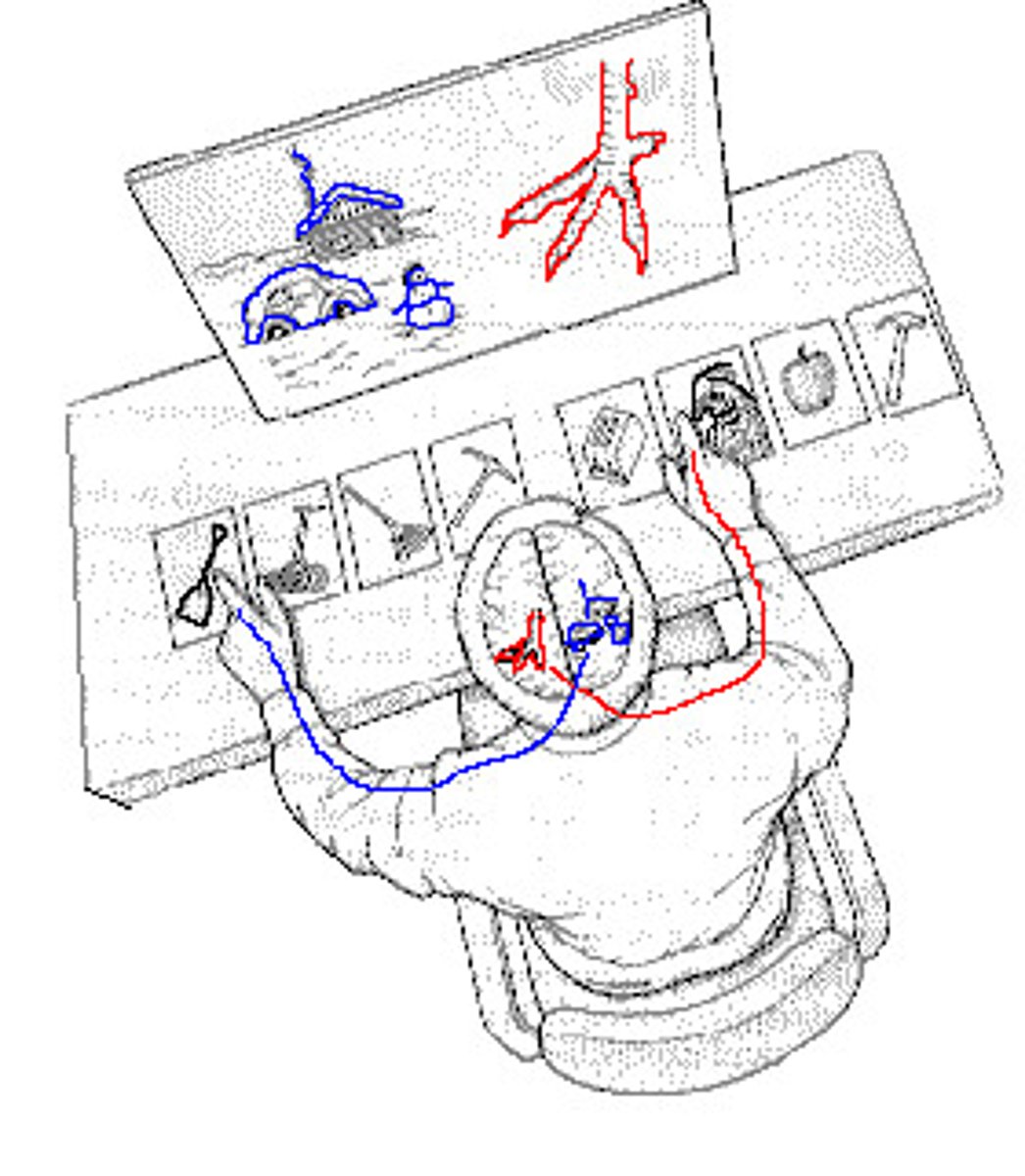 <p>I conducted split-brain research, highlighting the lateralization of brain functions.</p>