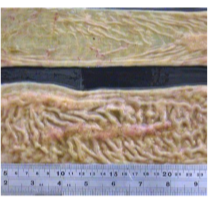 <ul><li><p>Mycobacterium avium subsp paratuberculosis infection </p><ul><li><p>chronic disease with infection starting early in age; clinical signs appear at an old age </p></li><li><p><strong>organism shed in feces even before clinical signs </strong></p></li><li><p><strong>protein-losing enteropathy: </strong>chronic weight loss, ventral edema, intermittent diarrhea </p></li></ul></li><li><p>diagnosis: </p><ul><li><p>fecal culture </p></li><li><p><strong>fecal PCR </strong></p></li></ul></li><li><p>treatment: no specific treatment </p></li><li><p>preventoin and control: </p><ul><li><p>cull or relocate affected animals </p></li><li><p>remove crais from positive moms; hand-feed them or orphan them </p></li><li><p>purchase colostrum or milk replacer only from confirmed negative farms </p></li><li><p>quarantine and test all new animals </p></li></ul></li></ul><p></p>