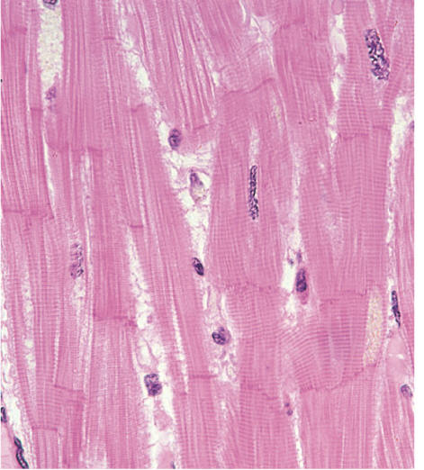 <p>Cardiac Muscle </p>