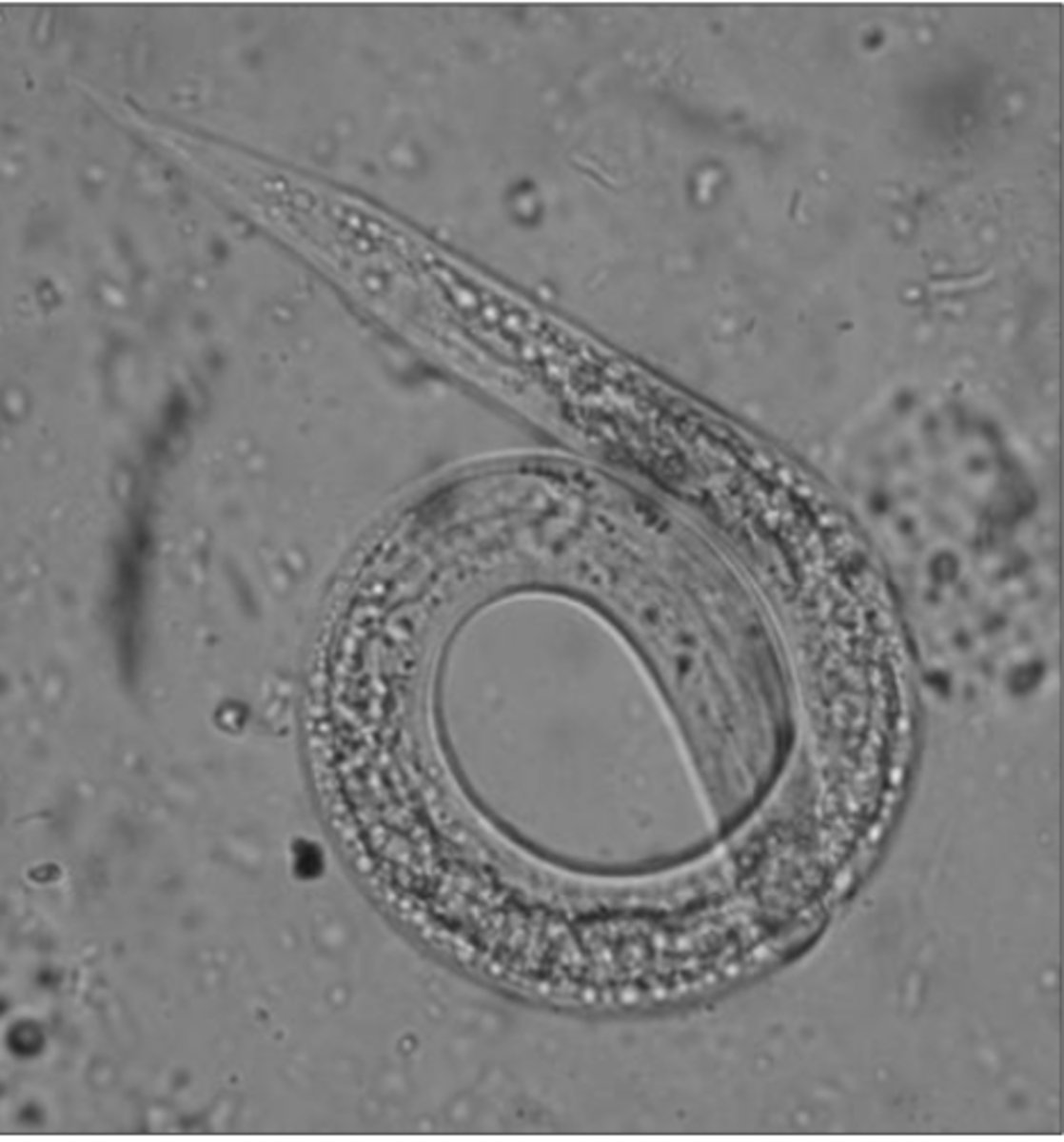 <p>Found in cow with severe cough and dyspnoea. What parasite is this?</p>