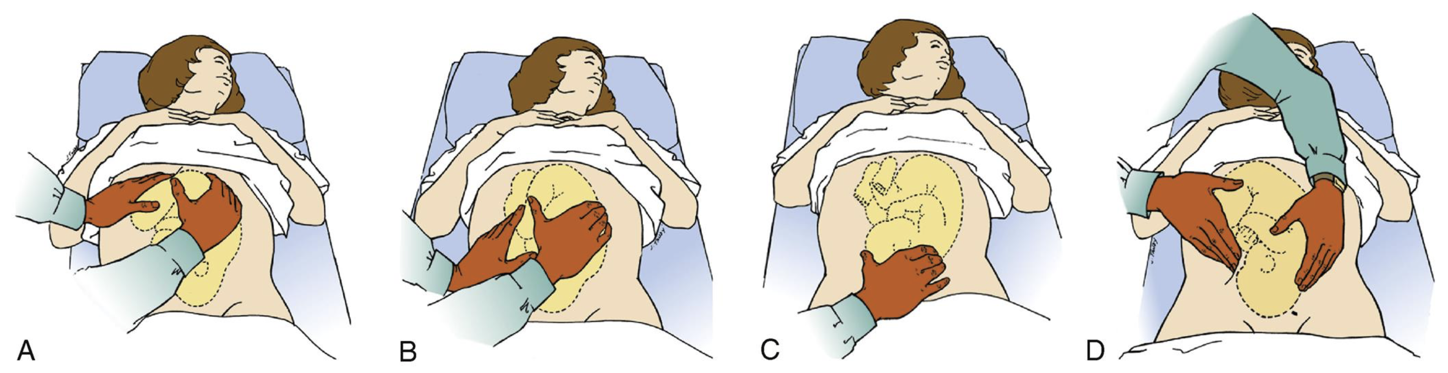 <p>number of fetuses</p><p>presenting part, fetal lie, and fetal attitude</p><p>degree of descent of the presenting part into the pelvis</p><p>location of fetus’s back to assess for fetal heart tones</p>