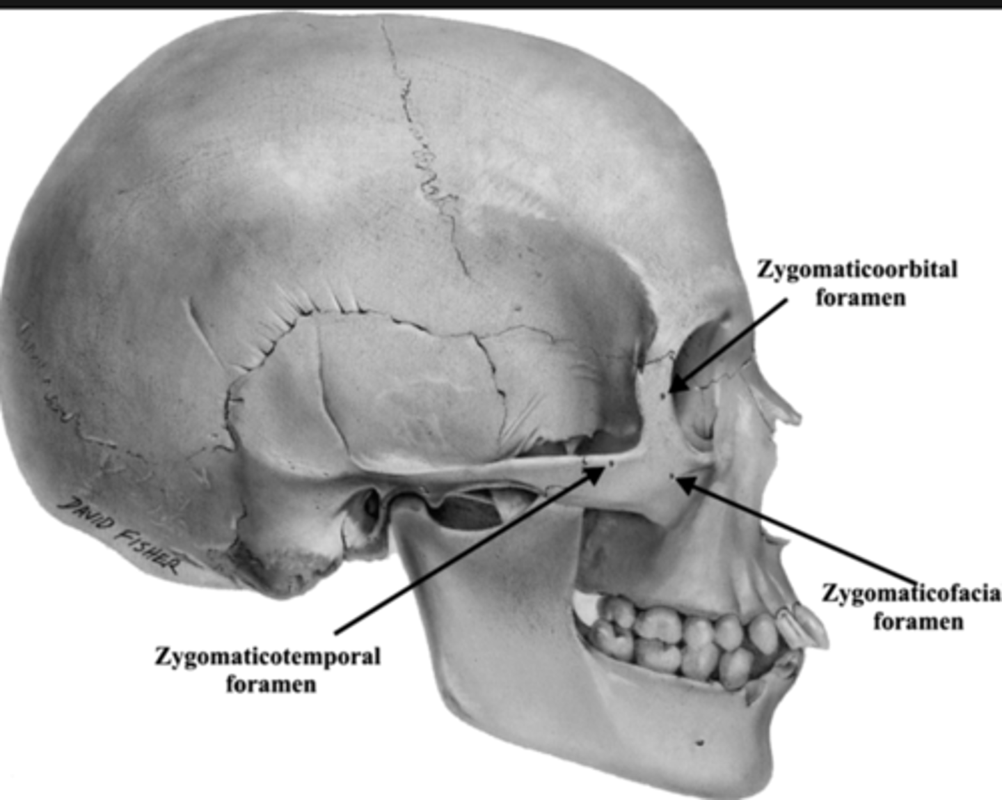 <p>1. In zygomatic bone, in the region of your temple</p><p>2. There are 2 more small foramen like this</p><p>3. Behind the cheek bone</p>